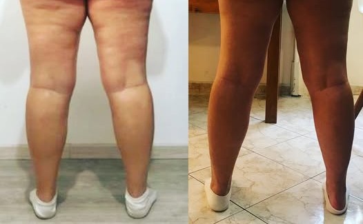 Mariana - foto ao lado do depoimento